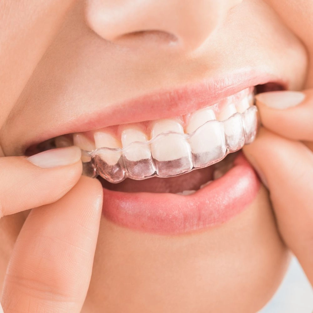 Dra. Isabella Pinheiro com alinhadores Invisalign